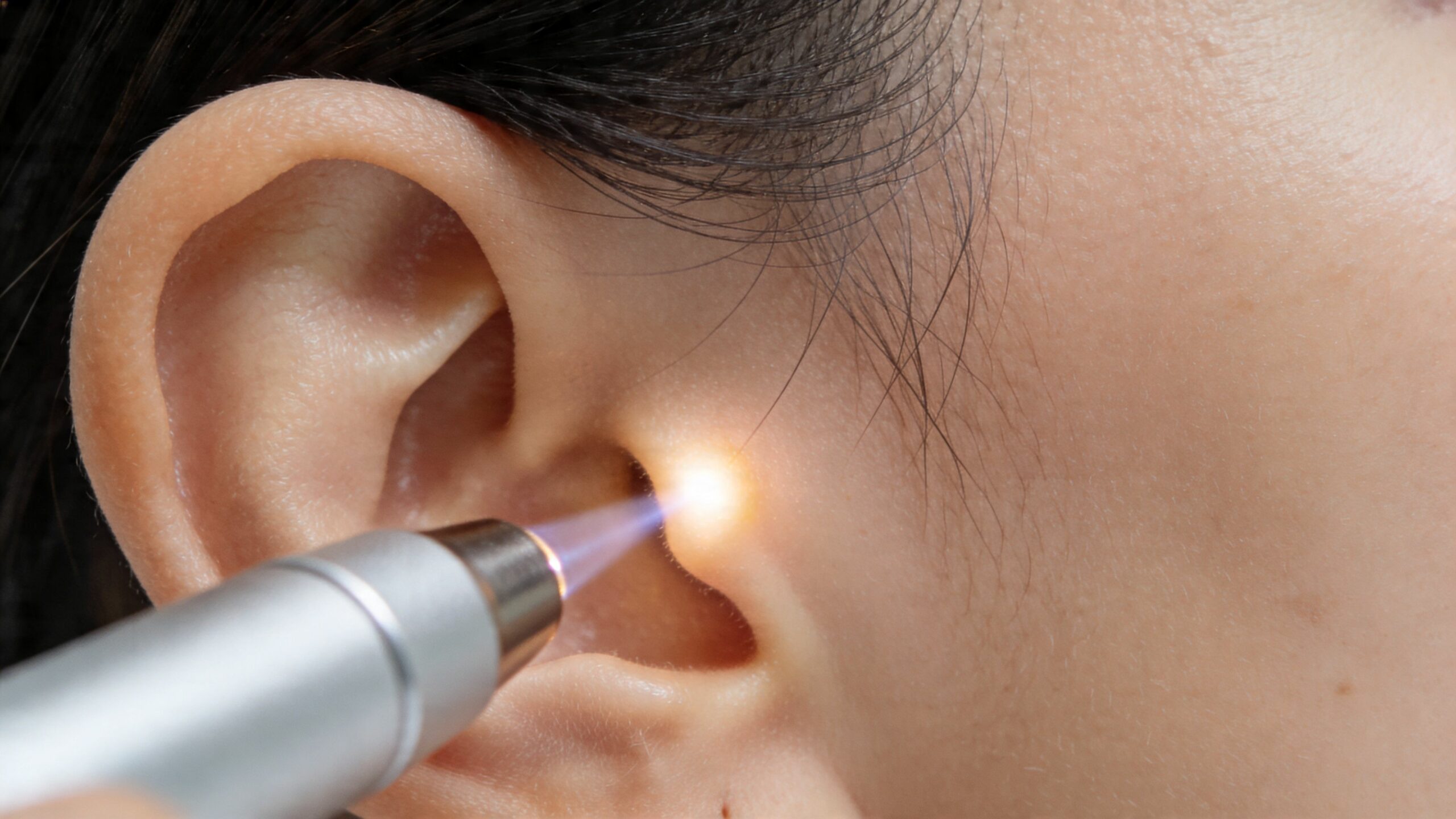 Une procédure de laser auriculaire pratiquée sur l'oreille d'une patiente pour un traitement médical sans médicament.