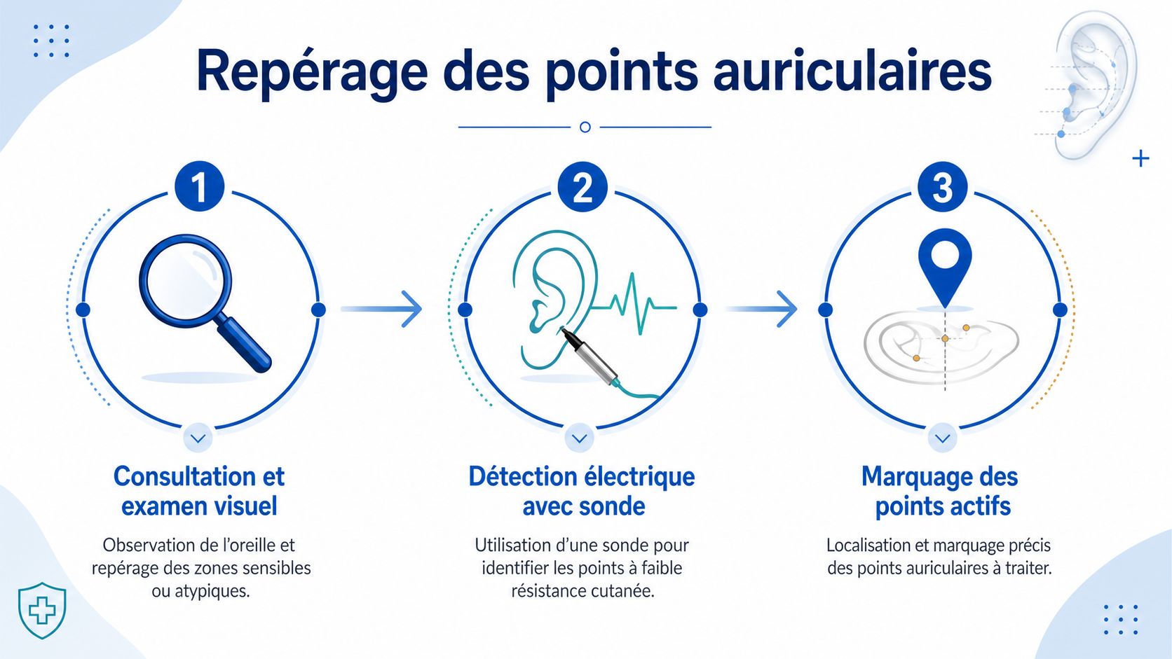 Comment se passe une séance d’auriculothérapie laser ? 2 Illustration montrant les trois étapes du repérage des points auriculaires lors d'une séance d'auriculothérapie.