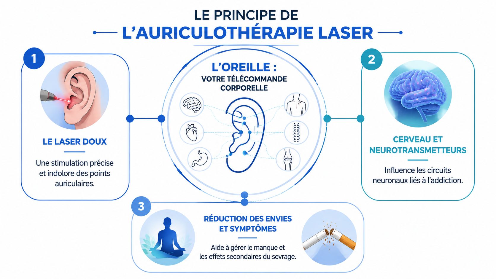 Schéma explicatif montrant le principe de l'auriculothérapie laser pour traiter l'addiction au tabac par stimulation auriculaire.