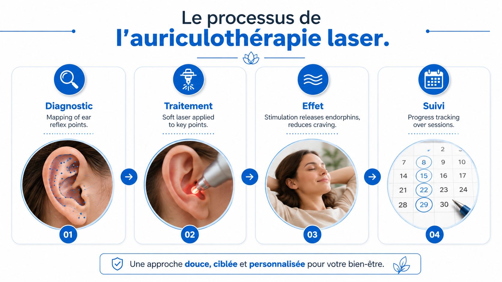 Infographie illustrant les quatre étapes du processus de traitement par auriculothérapie laser pour le bien-être.