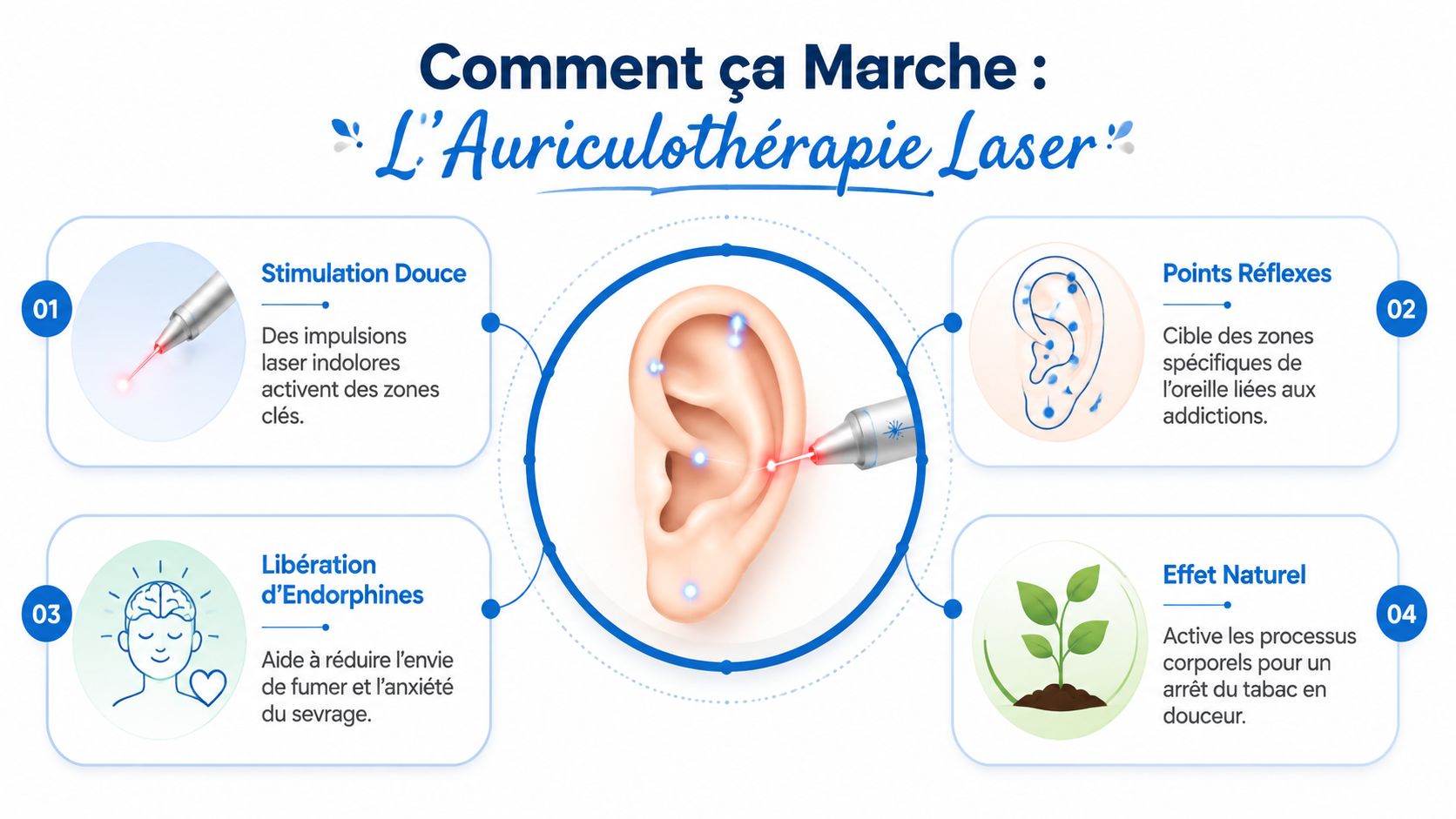 Infographie expliquant le fonctionnement de l'auriculothérapie laser pour aider à arrêter de fumer par stimulation auriculaire.
